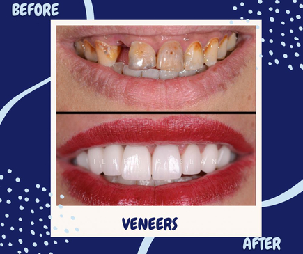 Slider image (4) Universe Dental - Best Dental Clinic in Tbilisi, Georgia